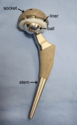 Picture of Hip Implant
